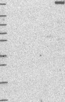 Western Blot: dedicator of cytokinesis 8 Antibody [NBP3-17049]