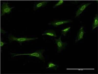 Immunocytochemistry/ Immunofluorescence: delta 2 Catenin Antibody (1E3) [H00001501-M02]