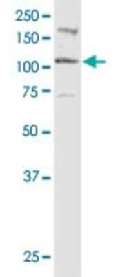 Western Blot: delta 2 Catenin Antibody (6E11) [H00001501-M01]