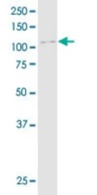 Western Blot: delta 2 Catenin Antibody (6E11) [H00001501-M01]