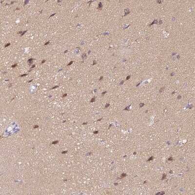 Immunohistochemistry: delta 2 Catenin Antibody [NBP2-47487]
