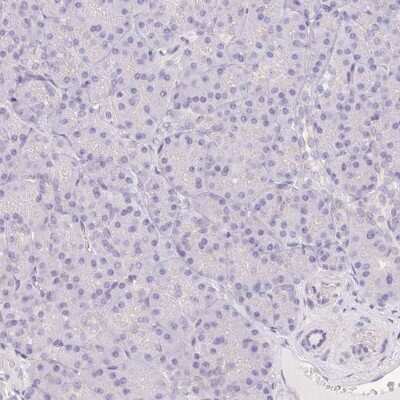 Immunohistochemistry-Paraffin: delta 2 Catenin Antibody [NBP2-47487]