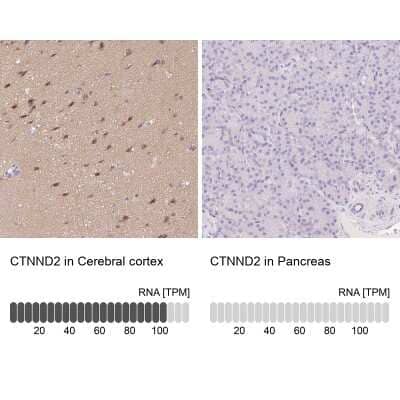 Immunohistochemistry-Paraffin: delta 2 Catenin Antibody [NBP2-47487]