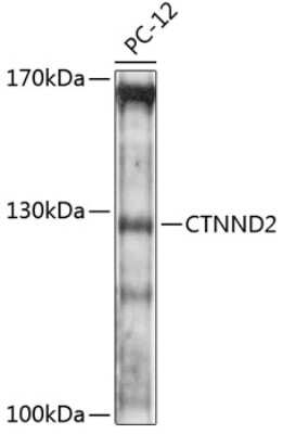 Western Blot: delta 2 Catenin AntibodyAzide and BSA Free [NBP3-03825]