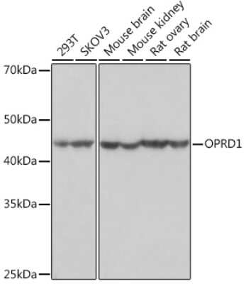 Western Blot: delta Opioid R/OPRD1 Antibody (1R4W8) [NBP3-16680]