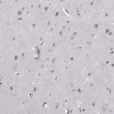 Immunohistochemistry: delta Opioid R/OPRD1 Antibody [NBP2-68910]