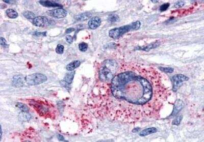 Immunohistochemistry-Paraffin: delta Opioid R/OPRD1 Antibody - BSA Free [NLS222]