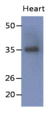 Western Blot: delta-Sarcoglycan Antibody (19G8)BSA Free [NBP2-42662]