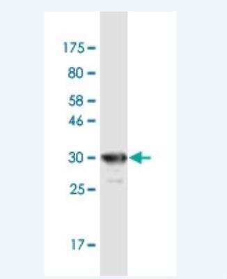 Western Blot: delta-Sarcoglycan Antibody (3G10) [H00006444-M01-100ug]