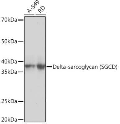 Western Blot: delta-Sarcoglycan Antibody (3P3R4) [NBP3-16776]