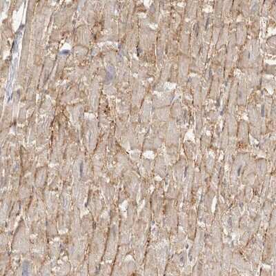 Immunohistochemistry-Paraffin: delta-Sarcoglycan Antibody [NBP1-85545]