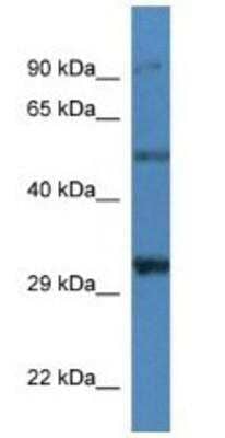 Western Blot: delta-Sarcoglycan Antibody [NBP1-74201]