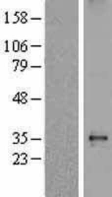 Western Blot: delta-Sarcoglycan Overexpression Lysate [NBL1-15904]