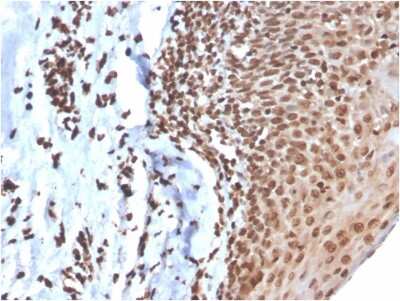 Immunohistochemistry-Paraffin: dsDNA Antibody (DSD/4054R) - Azide and BSA Free [NBP3-08490]