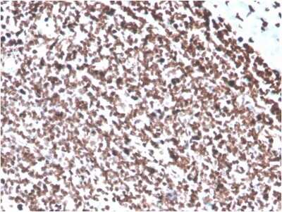 Immunohistochemistry-Paraffin: dsDNA Antibody (DSD/4054R) [NBP3-07302]