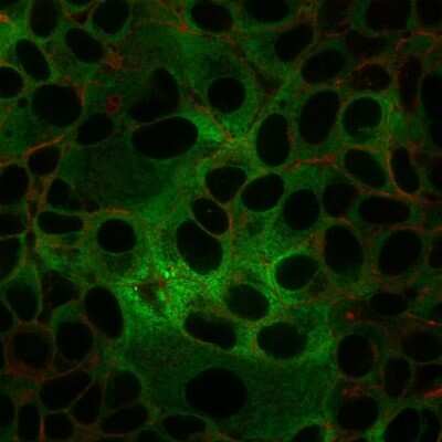 Immunocytochemistry/ Immunofluorescence: dsDNA Antibody (rDSD/4565) - Azide and BSA Free [NBP3-08466]