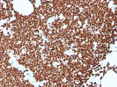 Immunohistochemistry-Paraffin: dsDNA Antibody (rDSD/4565) - Azide and BSA Free [NBP3-08466]