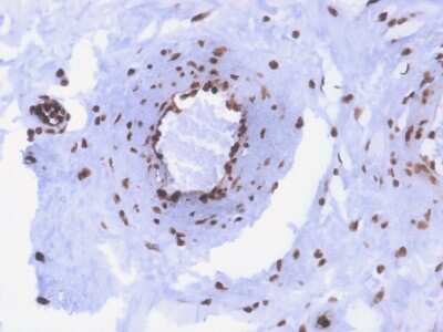 Immunohistochemistry-Paraffin: dsDNA Antibody (rDSD/4565) - Azide and BSA Free [NBP3-08466]