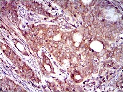 Immunohistochemistry: dynactin 4 Antibody (3G9D7) - BSA Free [NBP2-37399]