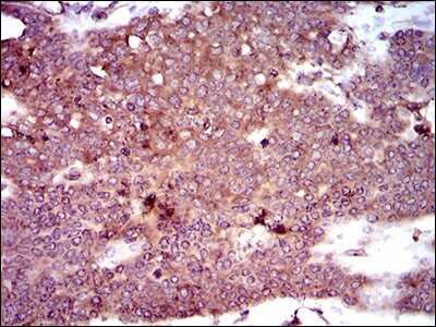 Immunohistochemistry: dynactin 4 Antibody (3G9D7) - BSA Free [NBP2-37399]
