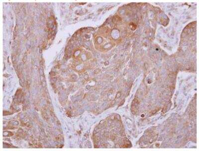 Immunohistochemistry-Paraffin: dynactin 4 Antibody [NBP2-16242]