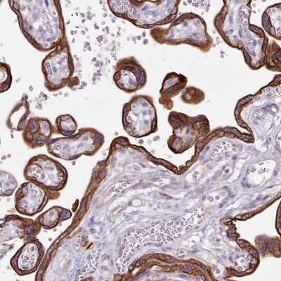 Immunohistochemistry-Paraffin: dynactin 4 Antibody [NBP2-38378]
