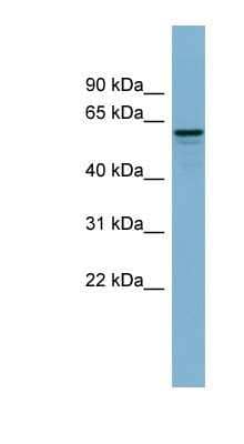 Western Blot: dynactin 4 Antibody [NBP1-55215]