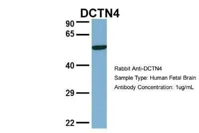 Western Blot: dynactin 4 Antibody [NBP1-55215]
