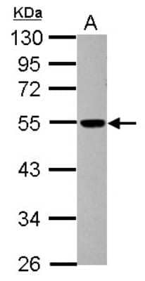 Western Blot: dynactin 4 Antibody [NBP2-16242]