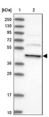 Western Blot: dynactin 4 Antibody [NBP2-38378]