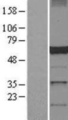 Western Blot: dynactin 4 Overexpression Lysate [NBL1-09753]