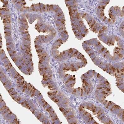 Immunohistochemistry-Paraffin: dynein, cytoplasmic 2, light intermediate chain 1 Antibody [NBP2-38008]