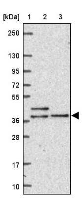 Western Blot: dynein, cytoplasmic 2, light intermediate chain 1 Antibody [NBP2-38008]