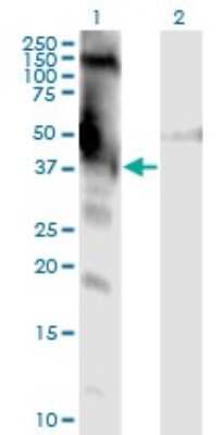 Western Blot: dystrophia myotonica containing WD repeat motif Antibody (3F5) [H00001762-M01]