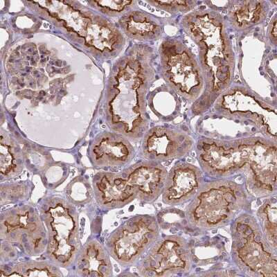 Immunohistochemistry-Paraffin: dystrophia myotonica containing WD repeat motif Antibody [NBP2-49548]