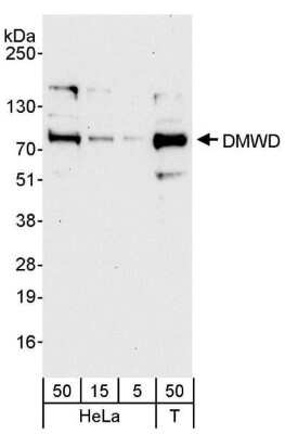 Western Blot: dystrophia myotonica containing WD repeat motif Antibody [NB100-95001]