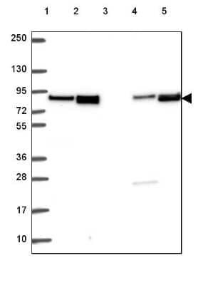 Western Blot: dystrophia myotonica containing WD repeat motif Antibody [NBP2-49548]