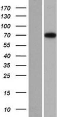 Western Blot: dystrophia myotonica containing WD repeat motif Overexpression Lysate [NBP2-10511]