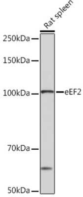 Western Blot: eEF-2 Antibody (4E2Z5) [NBP3-16866]