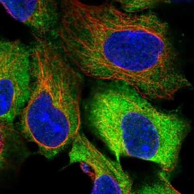 Immunocytochemistry/ Immunofluorescence: eEF-2 Antibody [NBP2-57792]
