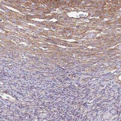 Immunohistochemistry: eEF-2 Antibody [NBP2-56755]