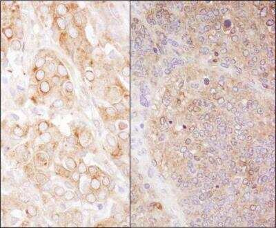 Immunohistochemistry-Paraffin: eEF-2 Antibody [NB100-87020]