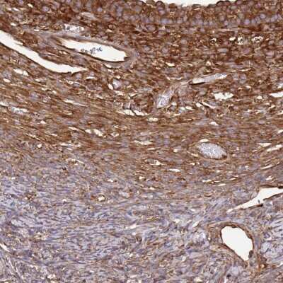 Immunohistochemistry-Paraffin: eEF-2 Antibody [NBP2-57792]