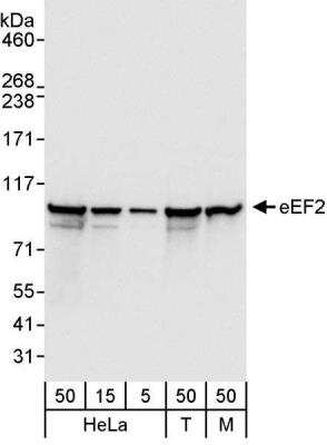 Western Blot: eEF-2 Antibody [NB100-87020]