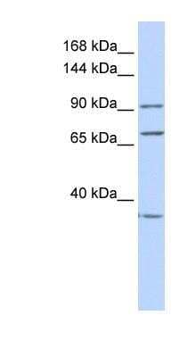 Western Blot: eEF-2 Antibody [NBP1-54383]