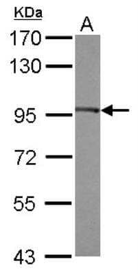 Western Blot: eEF-2 Antibody [NBP2-16274]