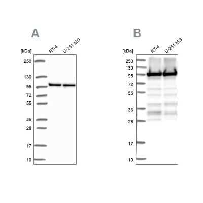 Western Blot: eEF-2 Antibody [NBP2-56755]