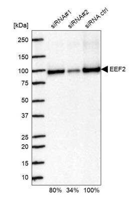 Western Blot: eEF-2 Antibody [NBP2-57792]
