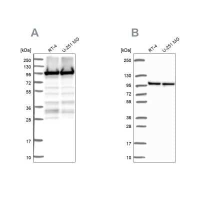 Western Blot: eEF-2 Antibody [NBP2-57792]