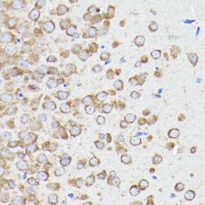 Immunohistochemistry-Paraffin: eEF1A1 Antibody - Azide and BSA Free [NBP2-92880]